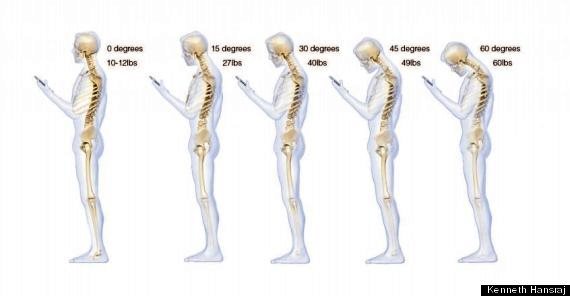 Texting your way to back pain